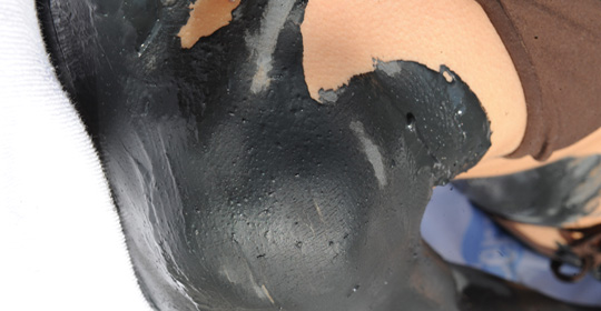 Il fango termale scioglie il dolore